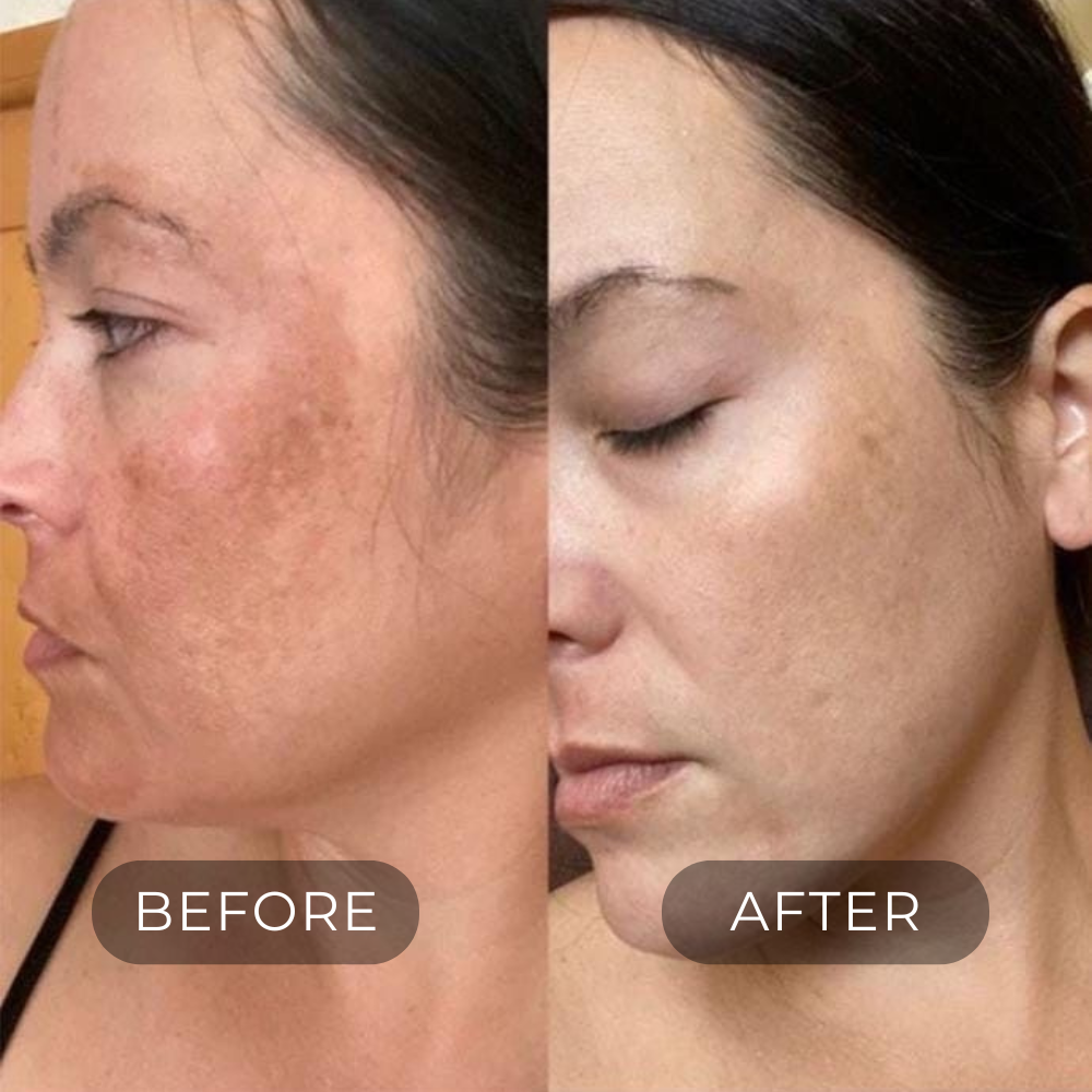 DARK SPOT CORRECTOR