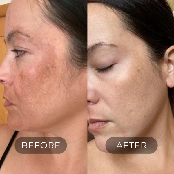 DARK SPOT CORRECTOR