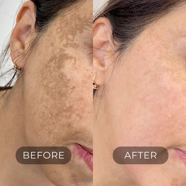 DARK SPOT CORRECTOR
