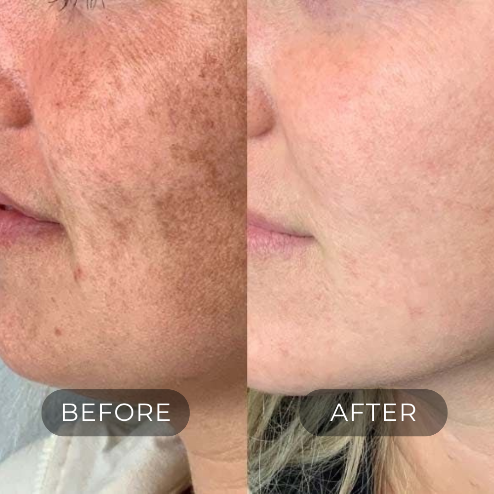 DARK SPOT CORRECTOR