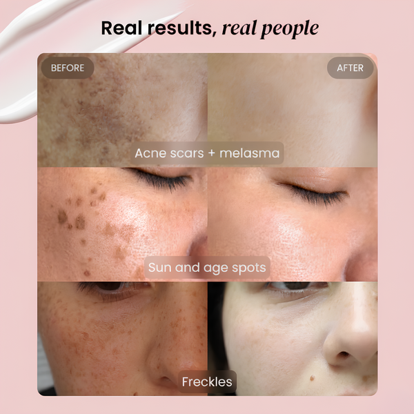 DARK SPOT CORRECTOR